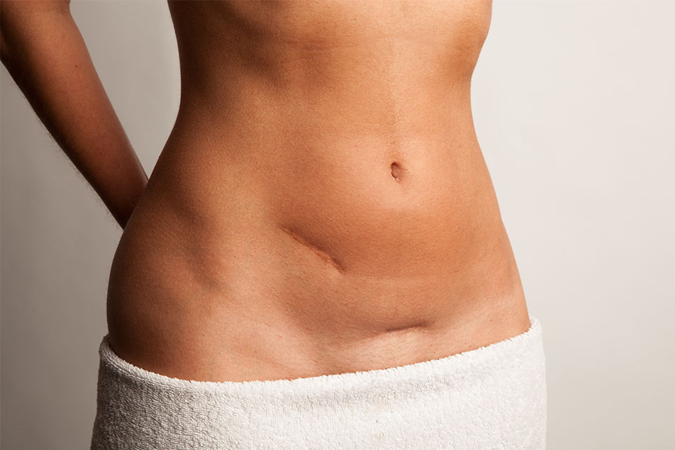 The cause of abdominal tightening after abdominal surgery