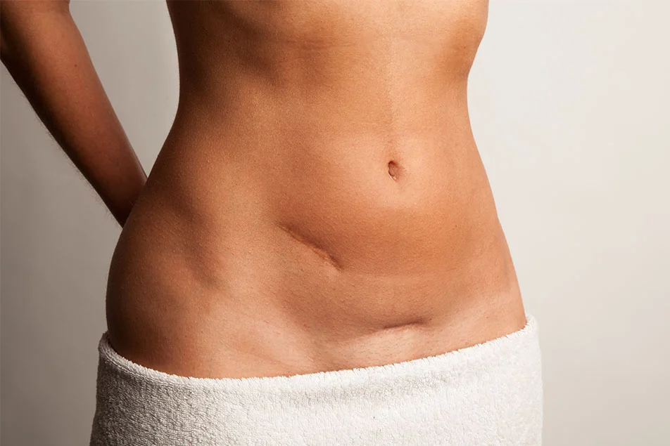 The cause of abdominal tightening after abdominal surgery