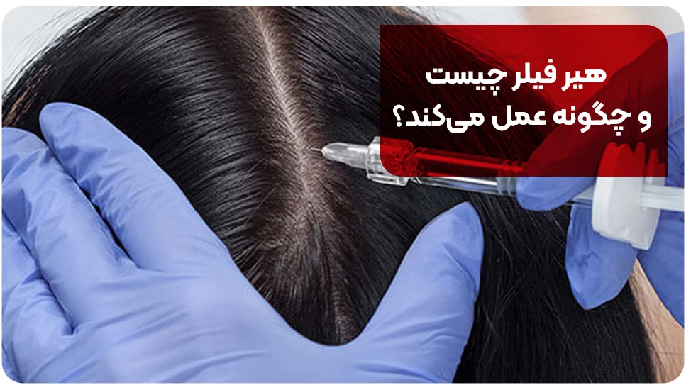 هیر فیلر چیست و چگونه عمل میکند؟