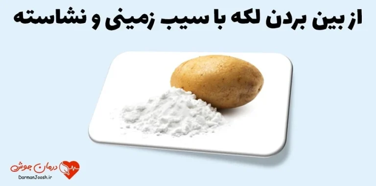 برای کاهش جوش صورت چی بخوریم؟